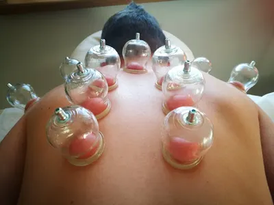 Długofalowo Akupunktura Dietetyka